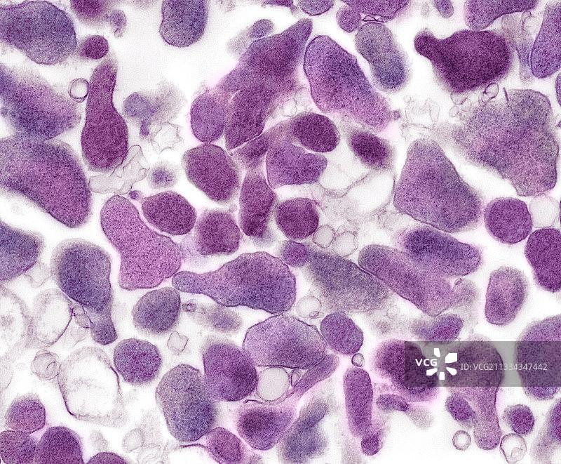 生殖支原体细菌，TEM显微图图片素材