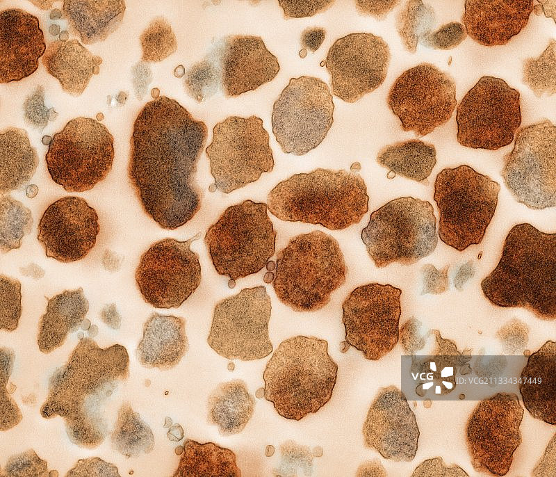 山羊支原体细菌，TEM图片素材