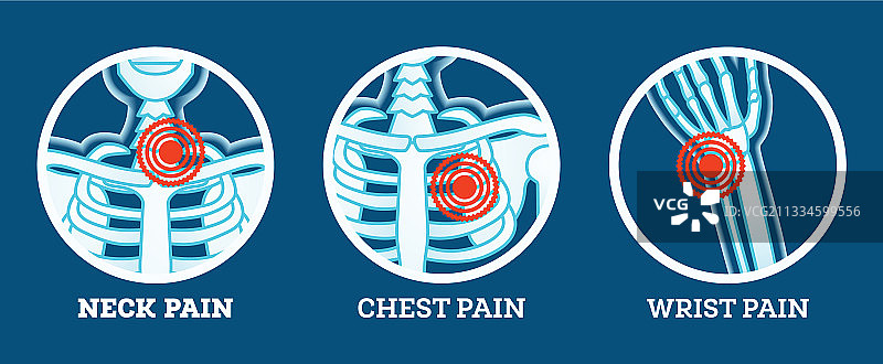 颈部、胸部和腕部疼痛图标集图片素材