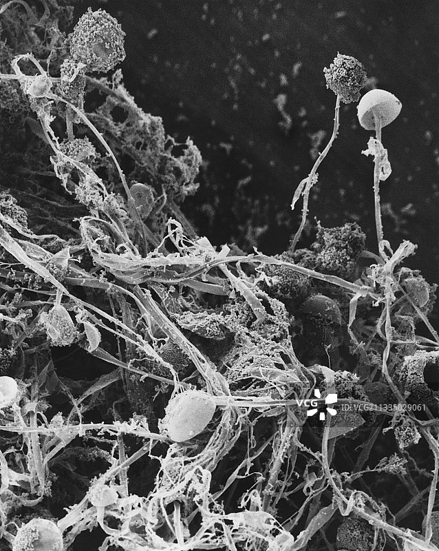 常见的面包霉菌图片素材