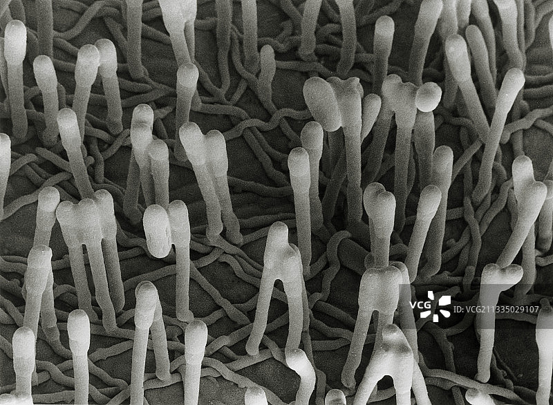致病性真菌豌豆白粉菌的扫描电镜图图片素材