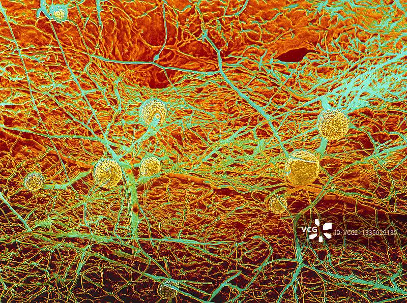 面包霉的伪彩色扫描电镜图图片素材
