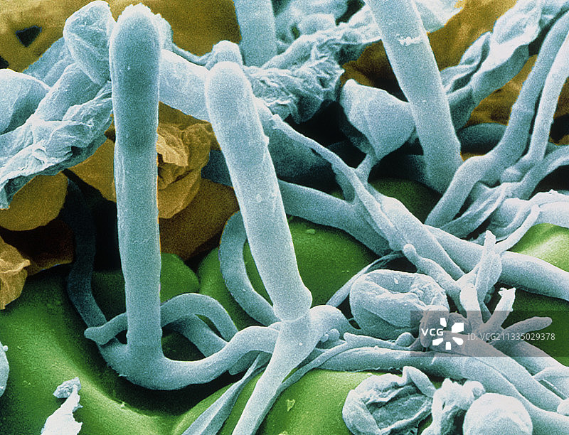 白粉菌的菌丝和子囊图片素材