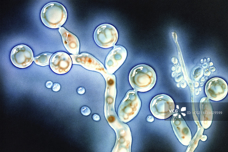 鹅口疮真菌（白色念珠菌）艺术图片素材