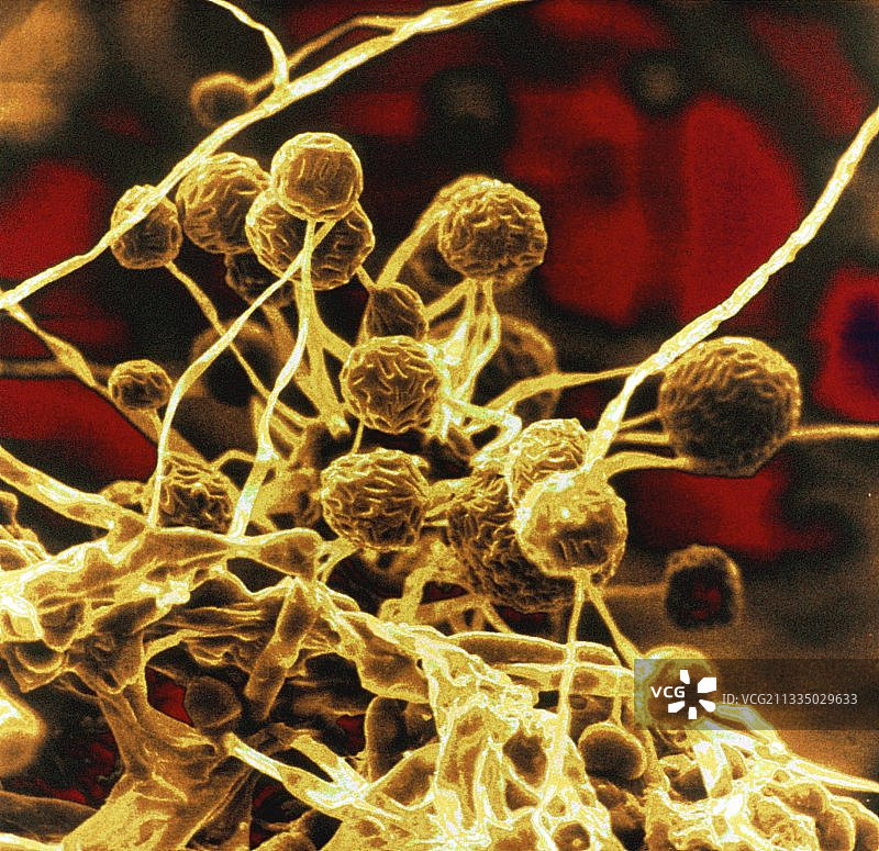 产黑酵母菌的彩色扫描电镜图像图片素材