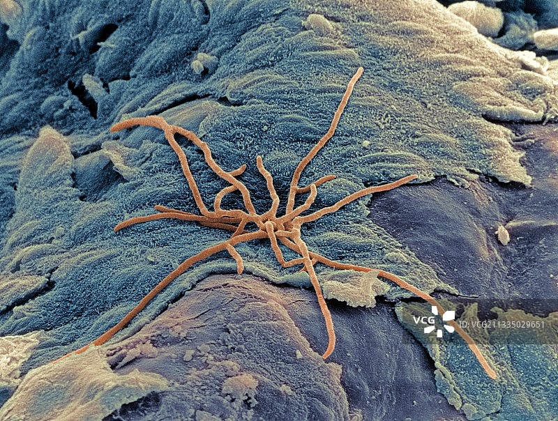 肺部真菌图片素材