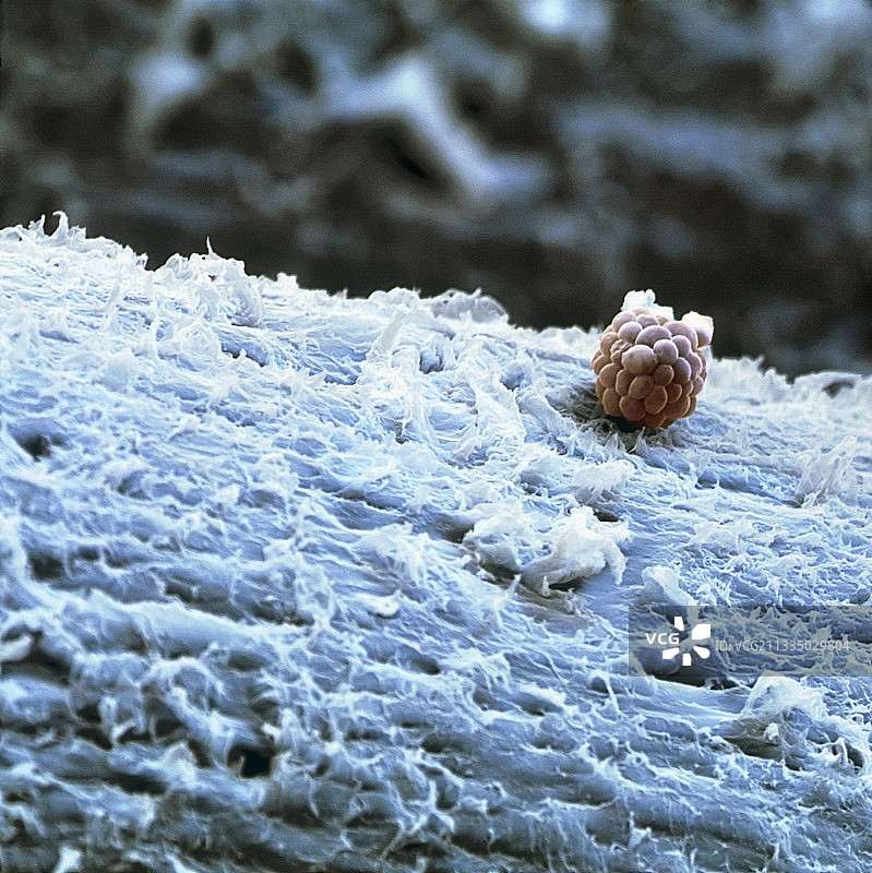 酵母细胞的扫描电子显微镜图像图片素材