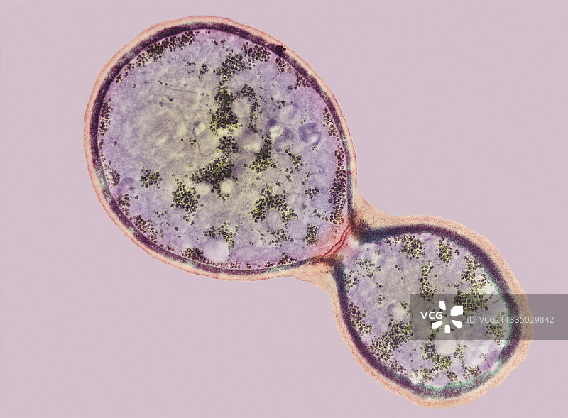 新型隐球菌细胞分裂，TEM图片素材