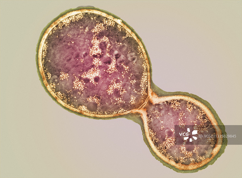 新型隐球菌细胞分裂，TEM图片素材
