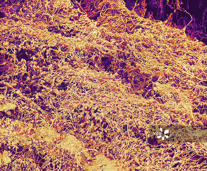 白面包霉菌，扫描电镜图片素材