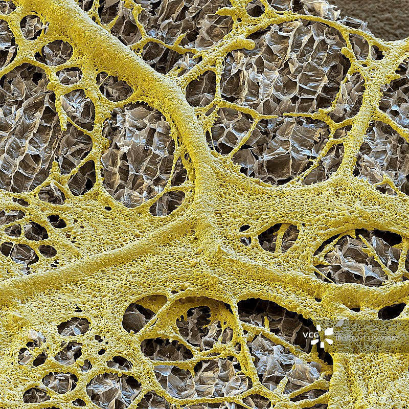 黏菌扫描电镜图图片素材