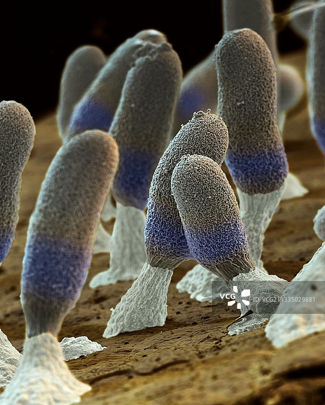 黏菌子实体扫描电镜图图片素材