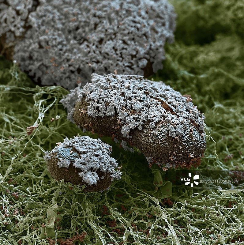 黏菌子实体扫描电镜图图片素材