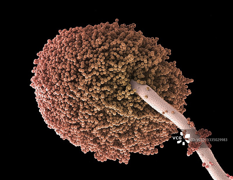 真菌孢子扫描电镜图图片素材