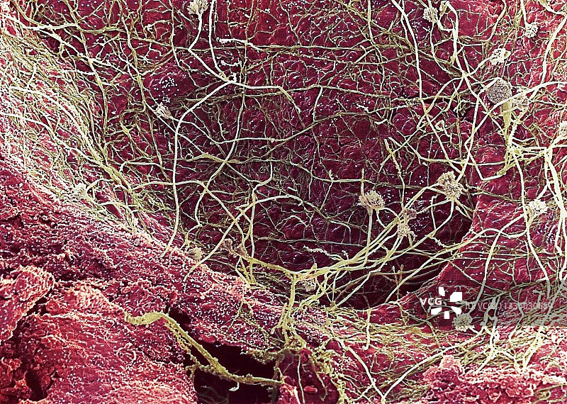 面包霉菌扫描电镜图图片素材