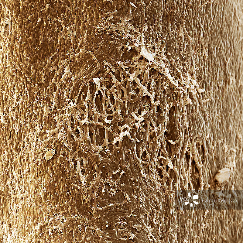 菌根，扫描电镜图片素材