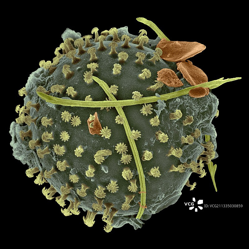 藻类平衡囊扫描电镜图图片素材