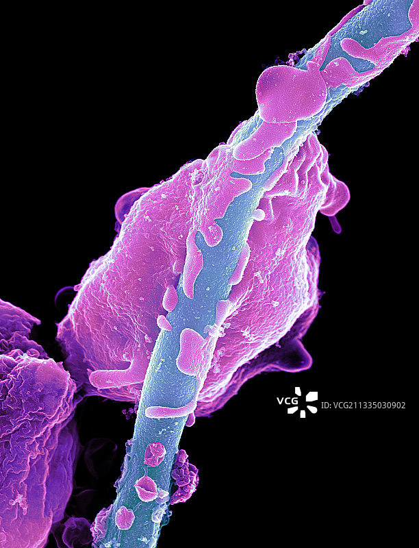 酵母感染粒细胞扫描电镜图图片素材