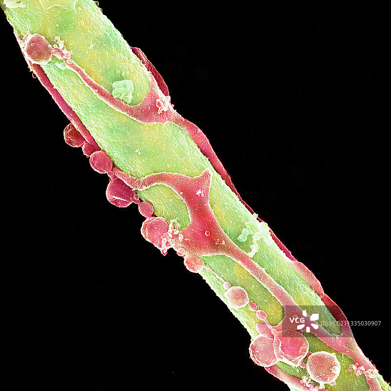 酵母感染粒细胞扫描电镜图图片素材