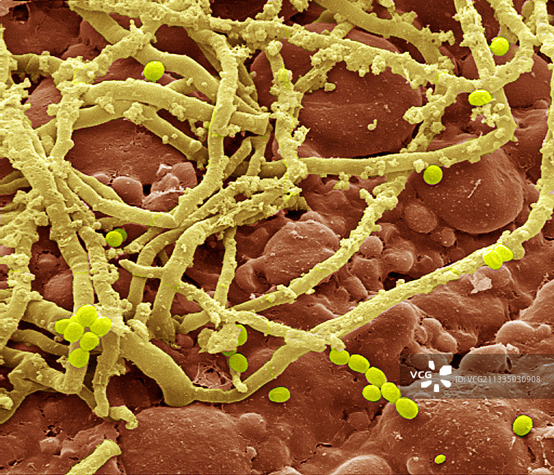 面包霉菌（青霉菌属），扫描电子显微镜图片素材