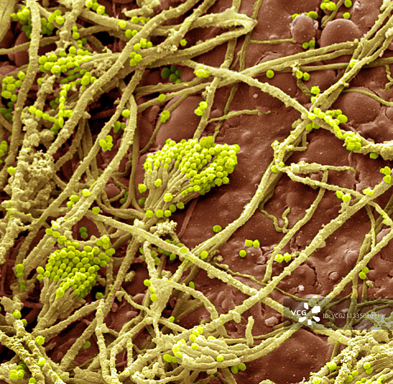 面包霉菌（青霉菌属），扫描电子显微镜图片素材