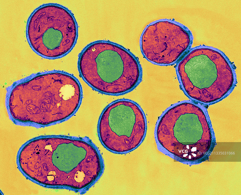 酵母细胞透射电镜图图片素材