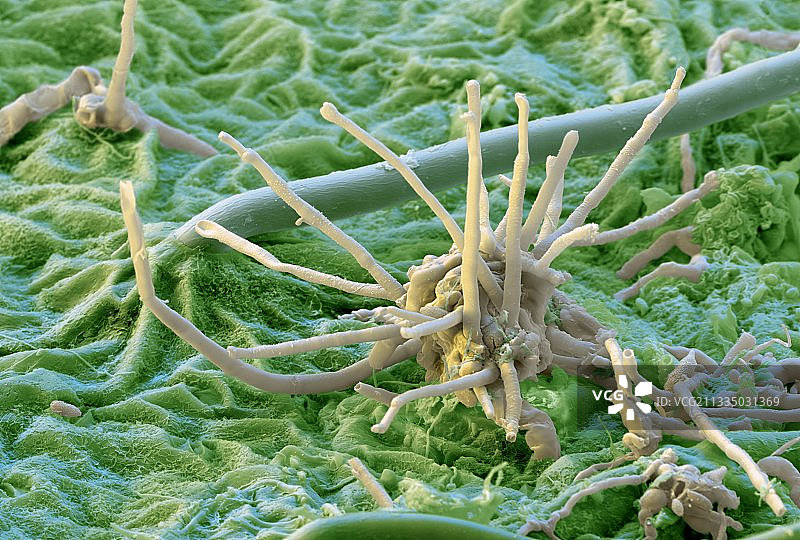 灰色霉菌，扫描电子显微镜图像图片素材