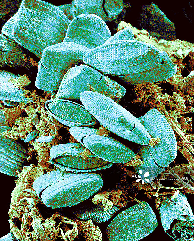 硅藻扫描电镜图图片素材