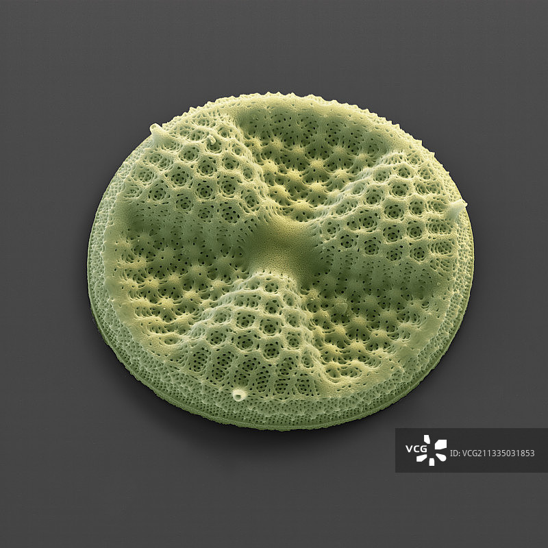 放射盘藻硅藻，扫描电镜图片素材