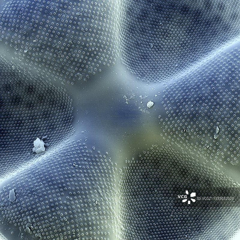 Diatom,没有图片素材