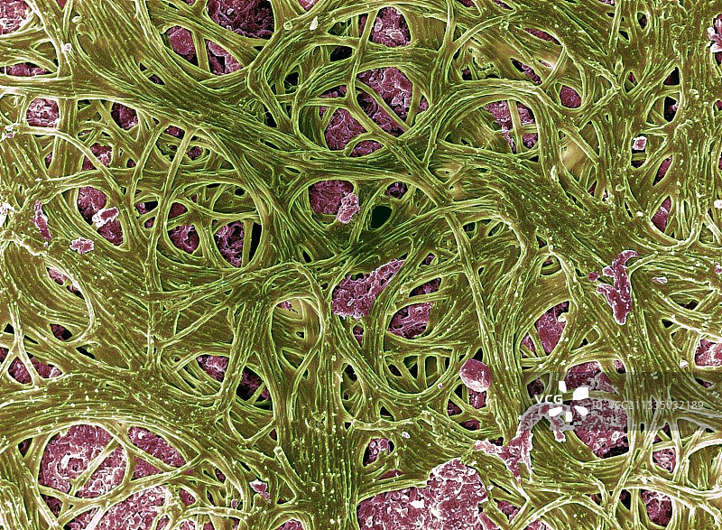 蓝藻扫描电镜图图片素材