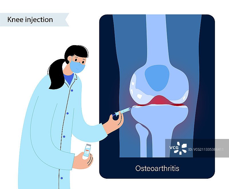 膝盖注射治疗图片素材