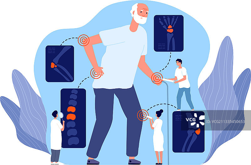 类风湿关节炎髌骨疼痛缓解图片素材