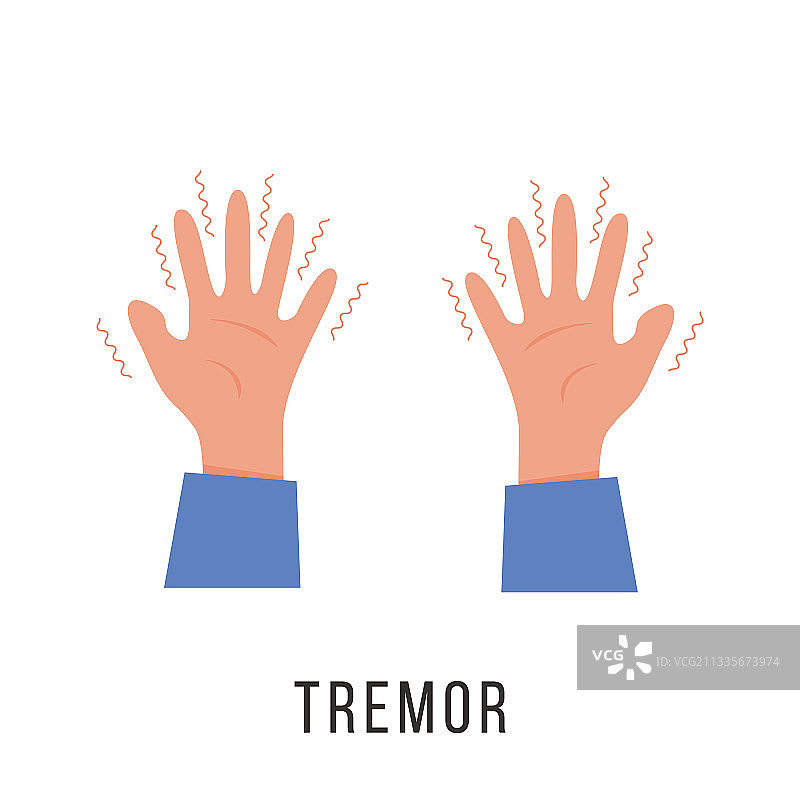 手部震颤帕金森病症状图片素材