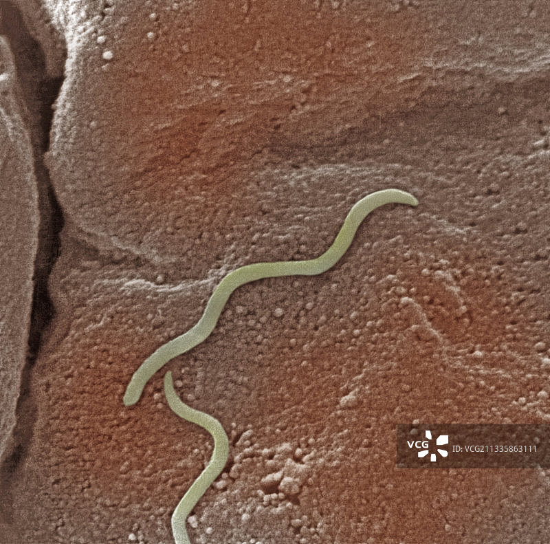 人结肠中的螺旋体细菌图片素材