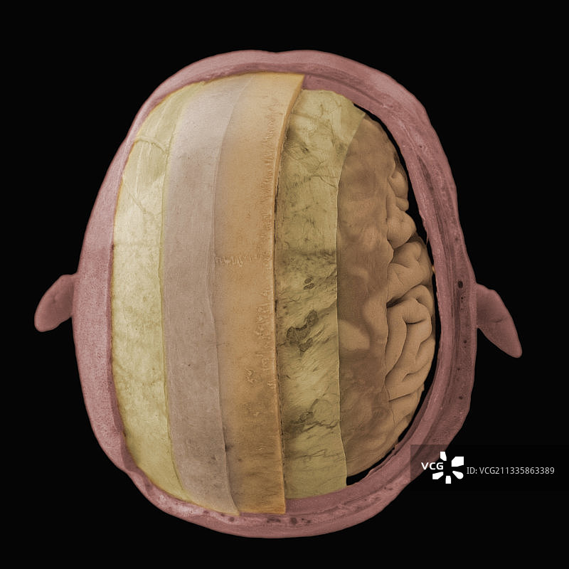 从上方解剖颅骨图片素材