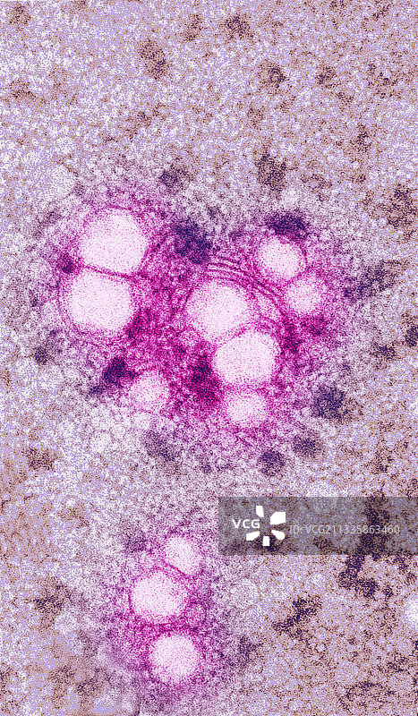 低密度和高密度脂蛋白图片素材