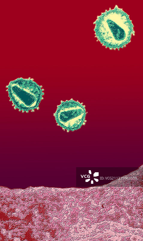 艾滋病毒病毒TEM X100,000图片素材