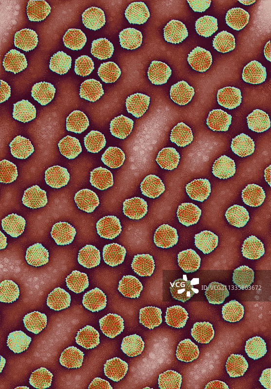 腺病毒上呼吸道感染图片素材