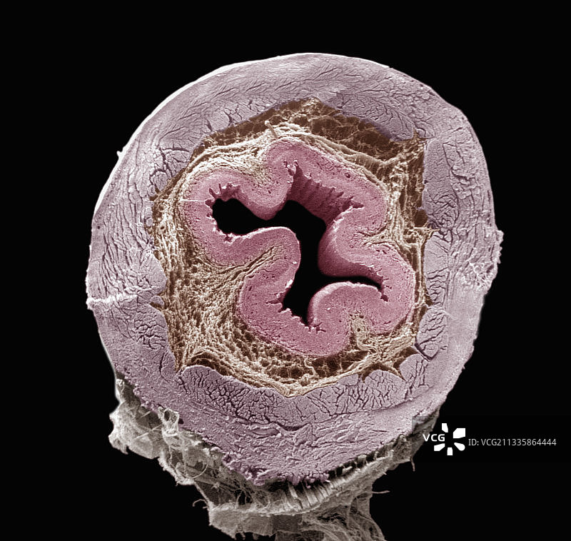 食道横截面图片素材