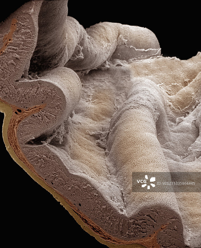 胃表面和壁截面扫描电镜图图片素材