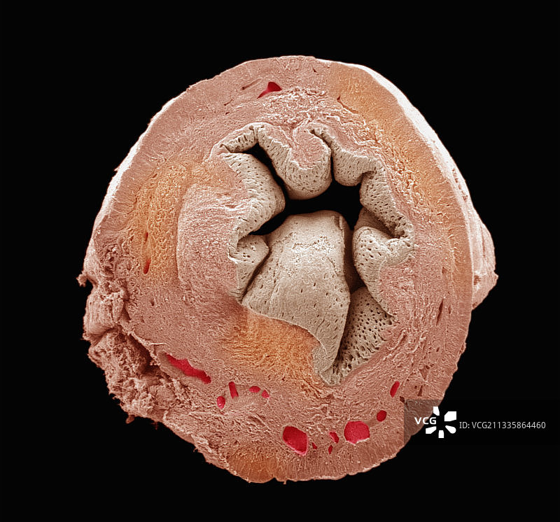 子宫横截面扫描电镜图图片素材