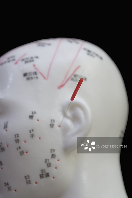 带有针灸针的人体模型图片素材
