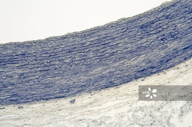主动脉壁弹性组织切面图片素材