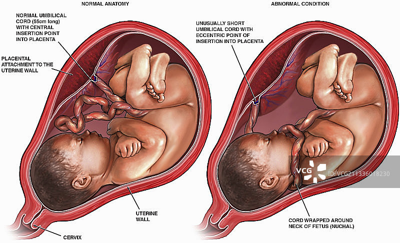 妊娠晚期胎儿插画图片素材