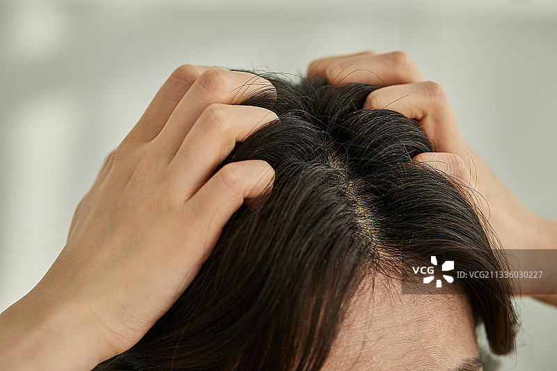 美容，脱发，头皮屑，焦虑，头皮护理图片素材