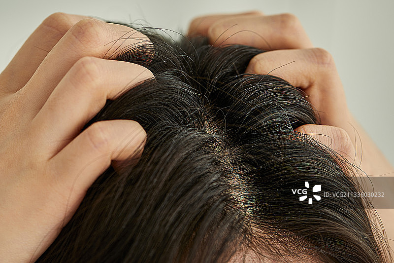 美容，脱发，头皮屑，焦虑，头皮护理图片素材