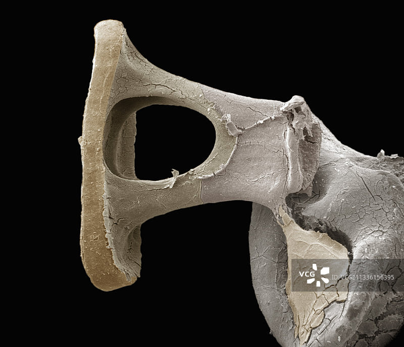 人中耳镫骨细节图片素材