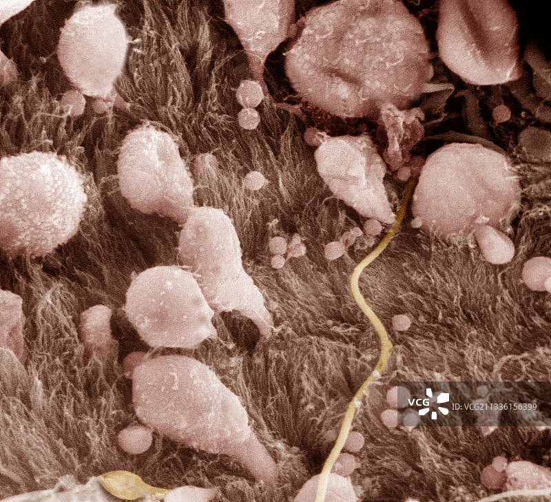 附睾内表面（扫描电镜）图片素材