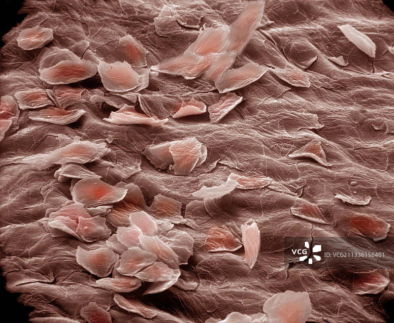 高度扁平细胞扫描电镜图图片素材